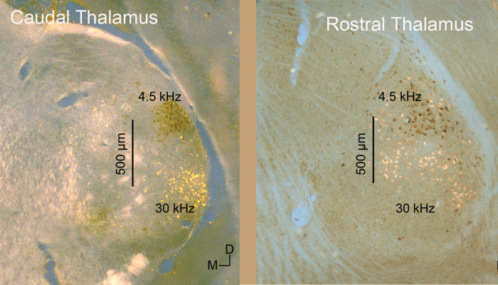 Tonotopic thalamocortical projection neurons segregated in caudal but not rostral thalamus.