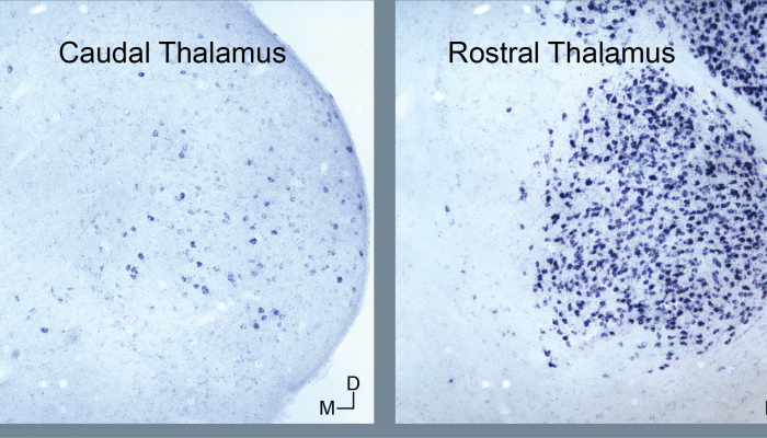 Different glutamate transporter Type 1 gene expression patterns in caudal and rostral thalamus.